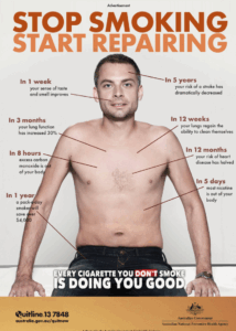 A shirtless man sits facing forward, pointing to various parts of his body. Text highlights the health benefits of quitting smoking over time, alongside a Quitline phone number and a slogan: Every cigarette you dont smoke is doing you good.